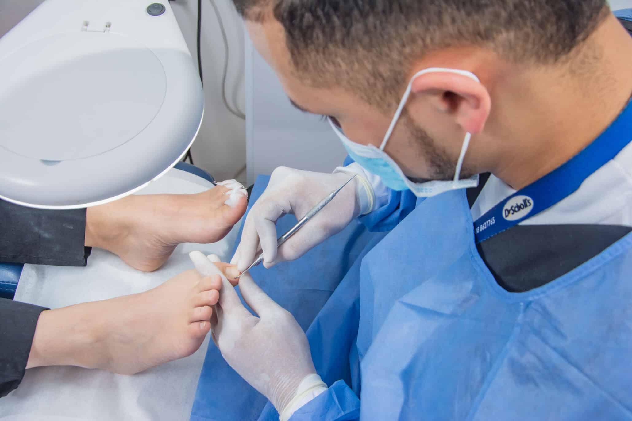 Tratamiento Especializado para Uñas Encarnadas en Bogotá y Chía